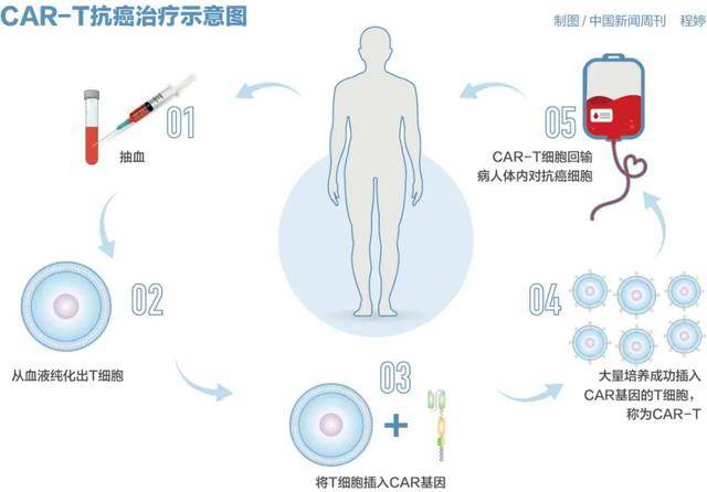 皇冠球网怎么做代理
_百万元的抗癌药皇冠球网怎么做代理
,有望大幅降价?