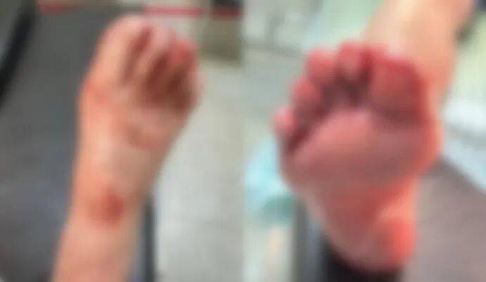 新2备用网址_洗澡时一声巨响新2备用网址，浙江小女孩腿上、脚上全是血！小心你家中藏的“不定时炸弹”……